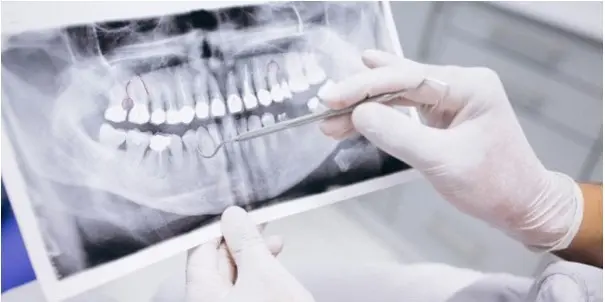 CBCT - The new way of medical imaging